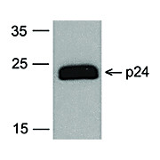 HIV-1 p24 Antibody [7F4] Biotin 100µg