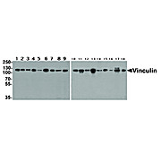Vinculin Antibody [7E10] 100µg
