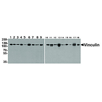 Vinculin Antibody [7E10] 100µg