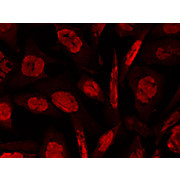 Anti-ATM Protein Kinase pS1981 (MOUSE) Monoclonal Antibody Peroxidase Conjugated, 100µg, Lyophilized