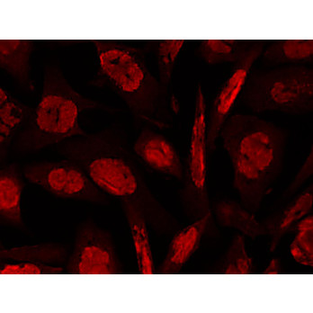 Anti-ATM Protein Kinase pS1981 (MOUSE) Monoclonal Antibody Peroxidase Conjugated, 100µg, Lyophilized
