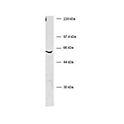 Anti-BIVM (C-terminal specific) (RABBIT) Antibody, 100µL, Liquid (sterile filtered)