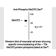 Anti-MeCP2 pS80 (Rabbit) Antibody, 100µL, Liquid