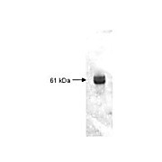 Anti-CARBOXYPEPTIDASE Y (RABBIT) Antibody, 2mL, Lyophilized