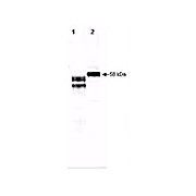 Anti-Fetuin (2-HS Glycoprotein) (GOAT) Antibody, 500µg, Lyophilized