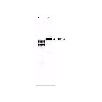 Anti-Fetuin (2-HS Glycoprotein) (GOAT) Antibody, 500µg, Lyophilized