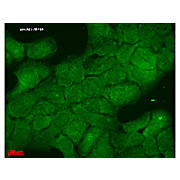 Anti-HSP40 (HDJ1) (MOUSE) Monoclonal Antibody, 100µg, Liquid (sterile filtered)