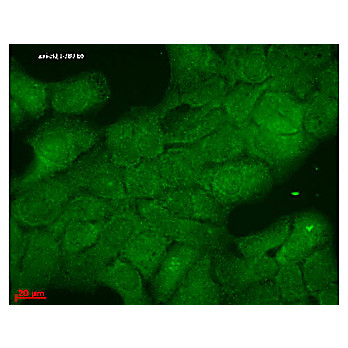 Anti-HSP40 (HDJ1) (MOUSE) Monoclonal Antibody, 100µg, Liquid (sterile filtered)