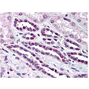 Anti-NFKB p65 (Rel A) pS276 (RABBIT) Antibody, 100µL, Liquid (sterile filtered)