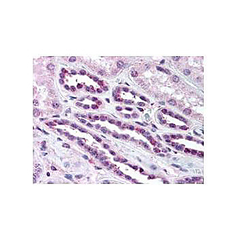 Anti-NFKB p65 (Rel A) pS276 (RABBIT) Antibody, 100µL, Liquid (sterile filtered)