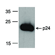 HIV-1 p24 Antibody [8G9] Biotin 100µg