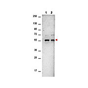 Anti-AKT (MOUSE) Monoclonal Antibody, 100µg, Liquid (sterile filtered)