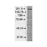 Anti-SHANK3 (MOUSE) Monoclonal Antibody, 100µg, Liquid (sterile filtered)