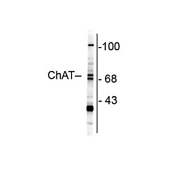 Anti-ChAT (Choline Acetyltransferase) (Rabbit) Antibody, 100µL, Liquid