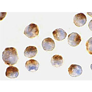 Anti-APAF1 (MOUSE) Monoclonal Antibody, 100µg, Liquid[2E10]  (sterile filtered)