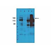 Anti-TET2 (RABBIT) Antibody, 100µL, Liquid (sterile filtered)