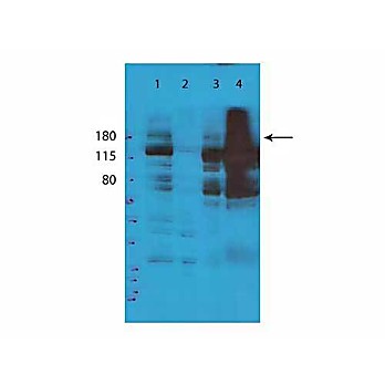 Anti-TET2 (RABBIT) Antibody, 100µL, Liquid (sterile filtered)