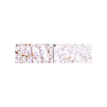 Anti-Mesothelin (MOUSE) Monoclonal Antibody, 100µg, Liquid (sterile filtered)
