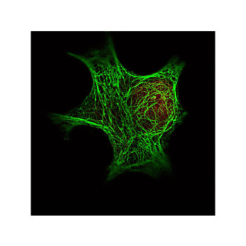 Anti-Keratin (MOUSE) Monoclonal Antibody, 100µg, Liquid (sterile filtered)