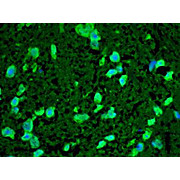 Anti-HSP22 (RABBIT) Antibody, 100µL, Liquid (sterile filtered)
