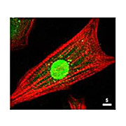 Anti-AKT (RABBIT) Antibody, 25µL, Liquid (sterile filtered)