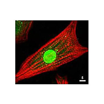 Anti-AKT (RABBIT) Antibody, 25µL, Liquid (sterile filtered)