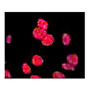 Anti-ATM Protein Kinase pS1981 (MOUSE) Monoclonal Antibody Biotin Conjugated, 100µg, Lyophilized