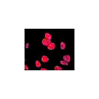 Anti-ATM Protein Kinase pS1981 (MOUSE) Monoclonal Antibody Biotin Conjugated, 100µg, Lyophilized