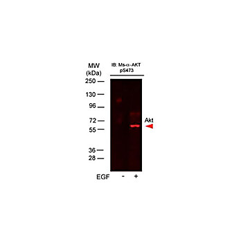 Anti-AKT pS473 (MOUSE) Monoclonal Antibody DyLight™ 649 Conjugated, 100µg, Lyophilized