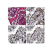 Anti-AHSP (RABBIT) Antibody, 25µL, Liquid (sterile filtered)