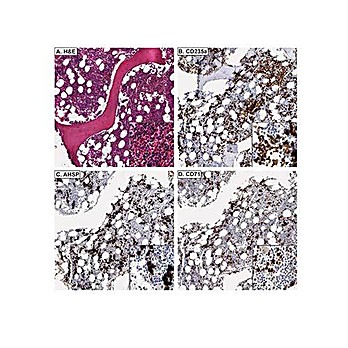 Anti-AHSP (RABBIT) Antibody, 25µL, Liquid (sterile filtered)