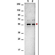 Anti-AKT (MOUSE) Monoclonal Antibody, 25µL, Liquid (sterile filtered)