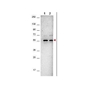 Anti-AKT (MOUSE) Monoclonal Antibody, 25µL, Liquid (sterile filtered)