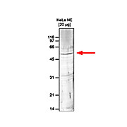 Anti-Set9 (RABBIT) Antibody, 100µL, Liquid (sterile filtered)