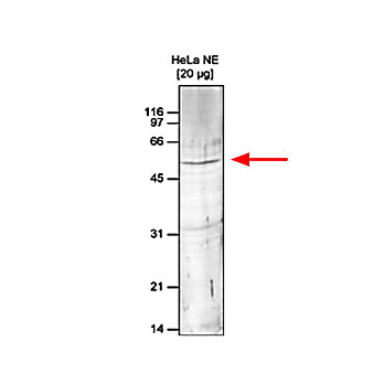 Anti-Set9 (RABBIT) Antibody, 100µL, Liquid (sterile filtered)
