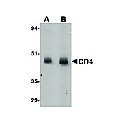 Anti-CD4 (MOUSE) Antibody, 100µg, Liquid[8G1B12]  (sterile filtered)