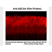 ABCA4 Rim Protein Antibody [3F4] 100µL