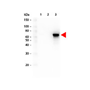 AKT3 FITC Antibody [25F6.F6.D8] 50µg