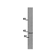 Anti-Wnt1 (MOUSE) Monoclonal Antibody, 25µL, Liquid (sterile filtered)