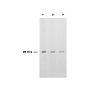 Anti-THYMIDYLATE SYNTHASE (RABBIT) Antibody, 100µL, Liquid (sterile filtered)