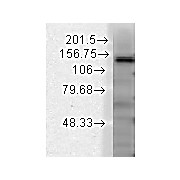 Anti-SLACK potassium channel (MOUSE) Monoclonal Antibody, 100µg, Liquid (sterile filtered)