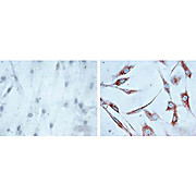 HSP60 Antibody [LK1] 200µg