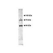 Anti-ALCOHOL DEHYDROGENASE (Yeast) (RABBIT) Antibody, 2mL, Lyophilized