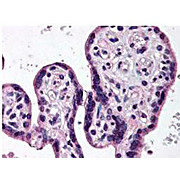 Anti-IKKß (RABBIT) Antibody, 100µL, Liquid (sterile filtered)