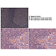 Anti-Sts-1 (RABBIT) Antibody, 100µg, Liquid (sterile filtered)