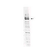 Anti-Human WHIP (RABBIT) Antibody, 100µg, Liquid (sterile filtered)