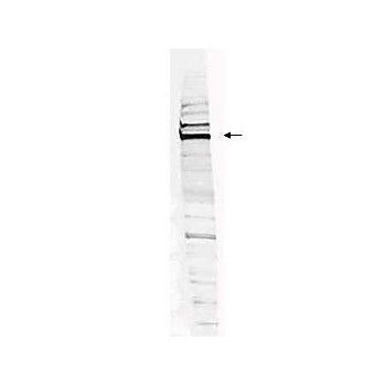 Anti-Human WHIP (RABBIT) Antibody, 100µg, Liquid (sterile filtered)