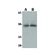 Anti-CXCR4-Lo (RABBIT) Antibody, 100µg, Liquid (sterile filtered)