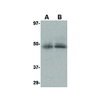 Anti-CXCR4-Lo (RABBIT) Antibody, 100µg, Liquid (sterile filtered)