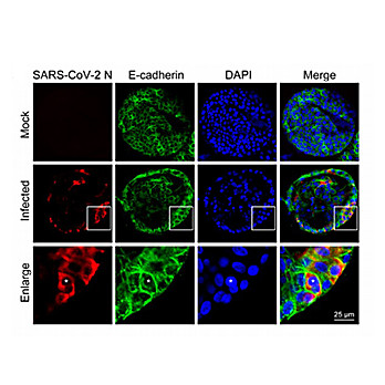 Anti-SARS-CoV Nucleocapsid (N) Protein (RABBIT) Antibody, 500µg, Lyophilized